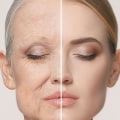 What is the most important thing for aging skin?