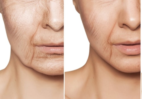 What does anti-aging skincare do?